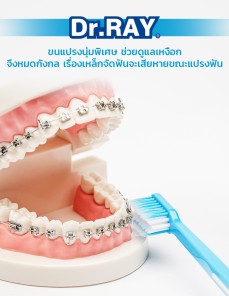 Orthodontic V_From China-006